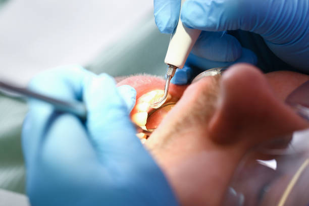 Best Emergency Dental Services for Seniors in Swartz Creek, MI