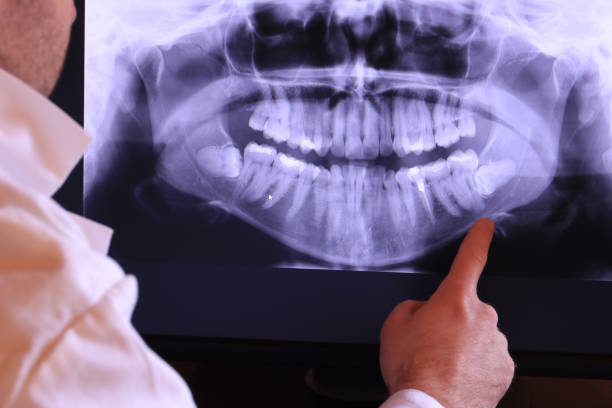 Best Pediatric Emergency Dentist in Swartz Creek, MI
