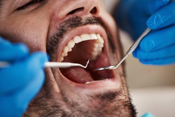 Best Emergency Dental Extractions in Swartz Creek, MI